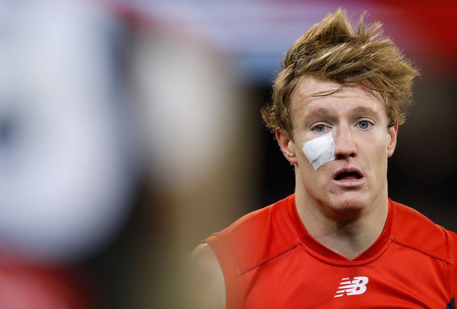 AFL 2016 Rd 12 - Melbourne v Collingwood MELBOURNE, AUSTRALIA - JUNE 13: Aaron vandenBerg of the Demons looks on during the 2016 AFL Round 12 match between the Melbourne Demons and the Collingwood Magpies at the Melbourne Cricket Ground on June 13, 2016 in Melbourne, Australia. (Photo by Michael Willson/AFL Media)